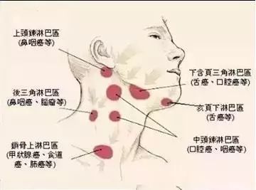 熬夜之后如何排毒