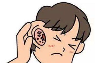 缓解耳鸣的小妙招