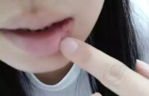 吃冬枣有什么好处吗