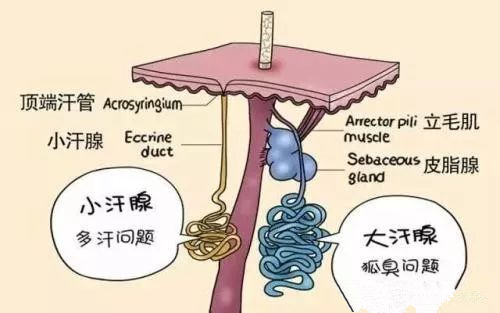 身体有汗臭是什么原因
