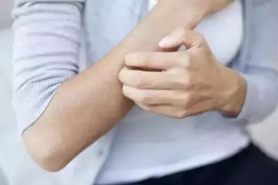 蚊子咬了怎么消肿止痒最快