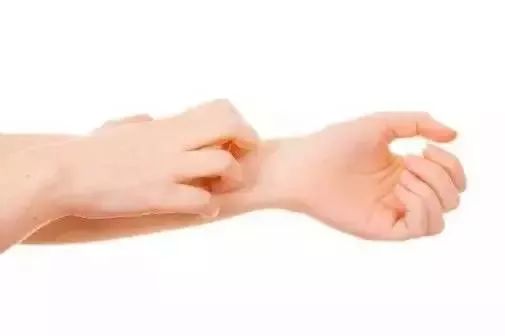 蚊子咬了怎么消肿止痒最快