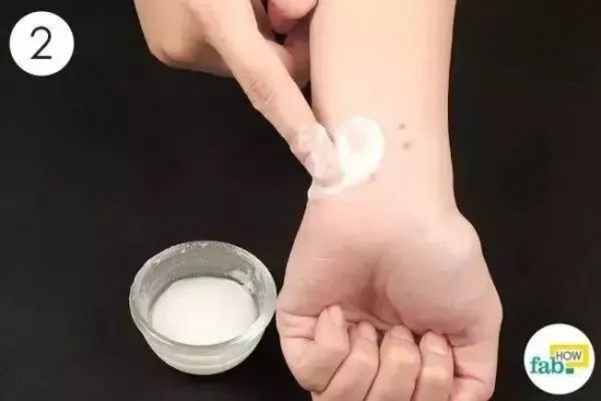 蚊子咬了怎么消肿止痒最快
