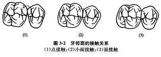 冲牙器是什么