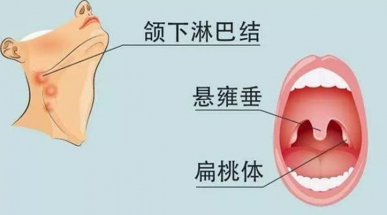 什么人容易得淋巴癌