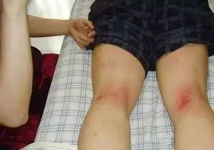 湿气重怎么调理
