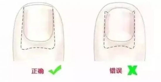 怎么给宝宝剪指甲