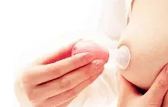 孕妇乳头凹陷怎么办啊 孕妇乳头凹陷怎么纠正
