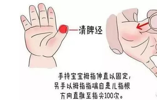 鹅口疮推拿手法 鹅口疮的推拿推哪里