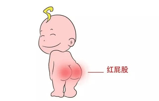 夏天婴儿红屁股怎么办 新生儿夏天屁屁红