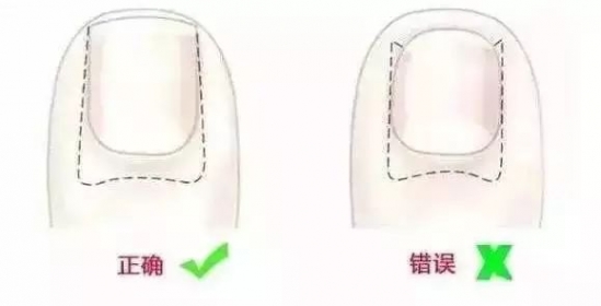 宝宝剪指甲的正确方法 乱给孩子剪指甲后果会很严重