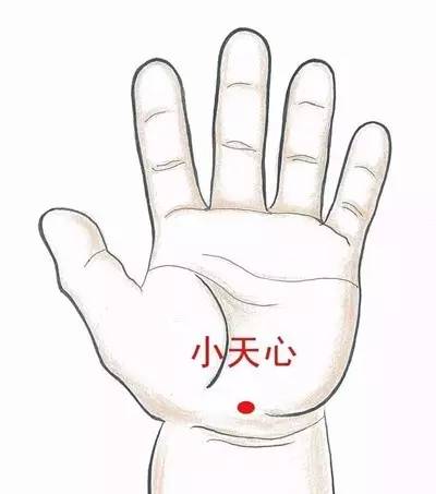 宝宝近视怎么办