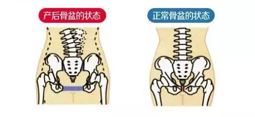 产后恢复哪些部分重要