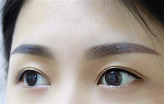 美瞳线几天掉痂 美瞳线掉痂要多少天