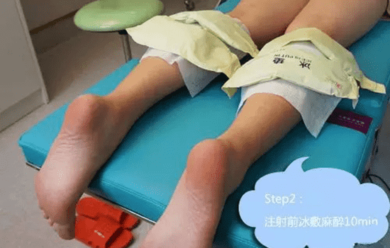 打瘦腿针过程图 瘦腿针的注射方法如下