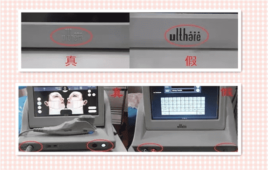 超声刀可以做胸部吗 超声刀能做胸吗