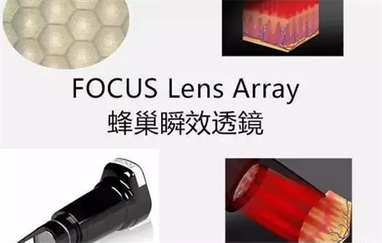 皮秒激光会反弹吗 蜂巢皮秒祛斑会反弹吗
