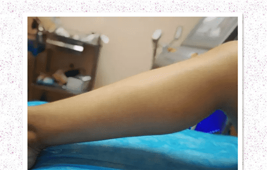 脱腿毛能永久吗 脱腿毛可以永久吗