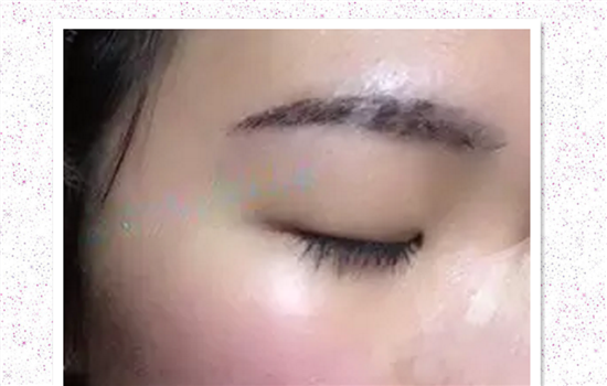 半永久雾眉恢复过程图 半永久眉恢复过程照片