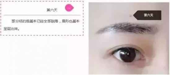 纹眉七天的变化