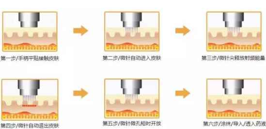疤怎么去除