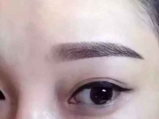 美瞳线的危害