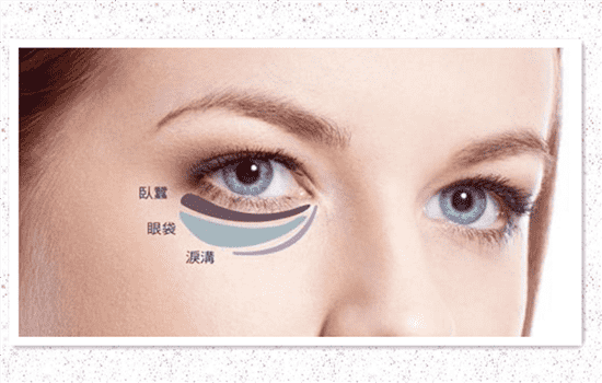 眼袋抽脂术多久能恢复正常 眼袋抽脂几天能恢复