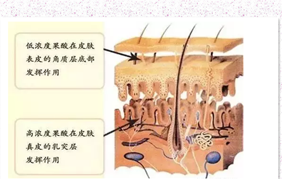 果酸换肤疼吗 果酸换肤疼不疼