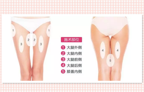 大腿吸脂有什么不好 大腿吸脂有什么危害