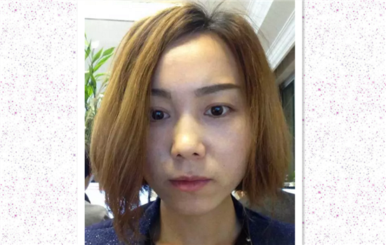 艾莉薇玻尿酸好不好 艾莉薇怎么样