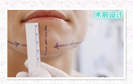 面部吸脂是永久的吗 吸脂瘦脸是永久的吗