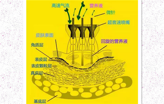 什么是无针水光 无针水光简介