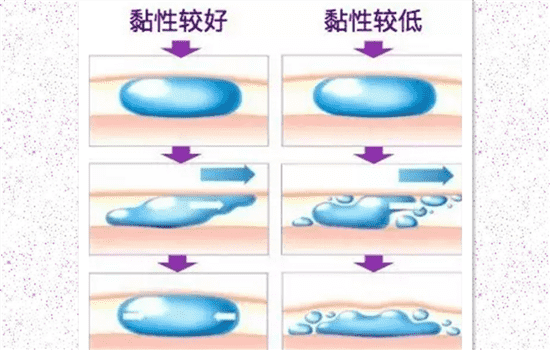 伊婉c型和v型的区别