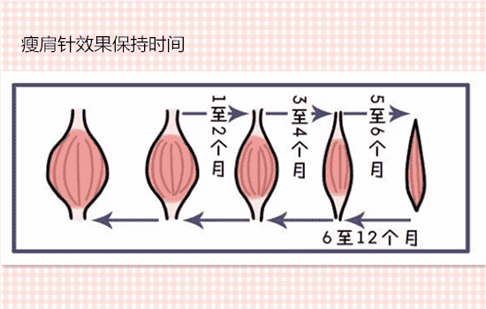 瘦肩针打几次可以定型 瘦肩针打几次才能永久