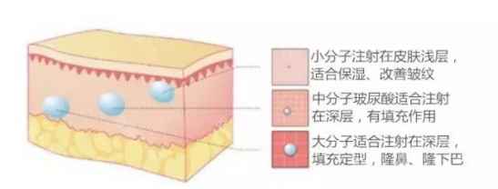 水光针和玻尿酸的区别