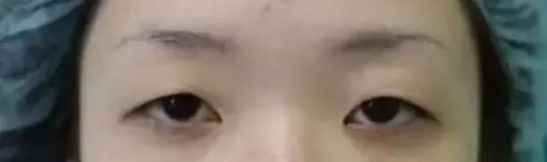 美瞳线和眼线有什么区别 美瞳线是什么