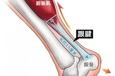 瘦小腿肚的最快方法 瘦小腿肚的小妙招