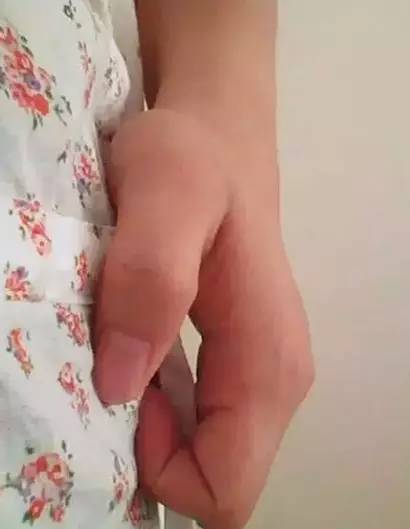 每天拍打肚子可以减腹部吗 每天拍肚子能瘦吗