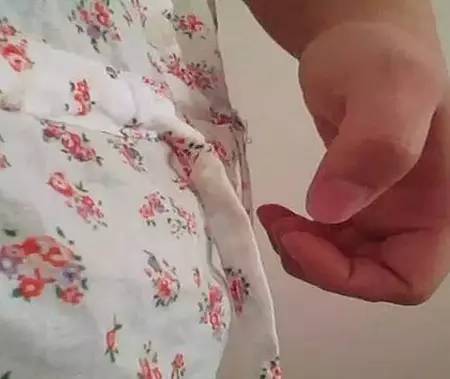 每天拍打肚子可以减腹部吗 每天拍肚子能瘦吗