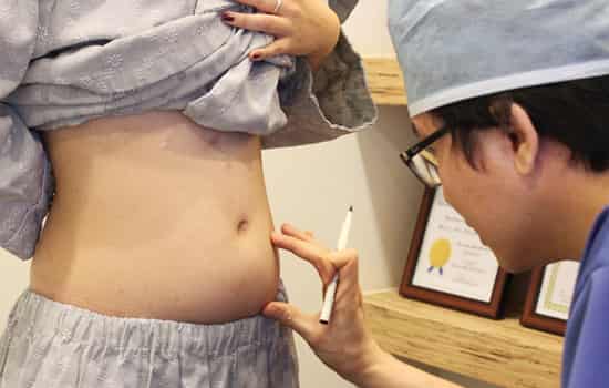 冷冻溶脂注意事项 冷冻溶脂后注意事项