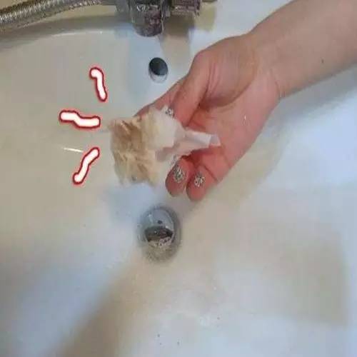 洗手台发霉发黄怎么办