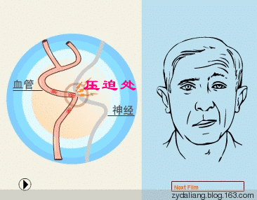 左眼跳财右眼跳灾是真的吗