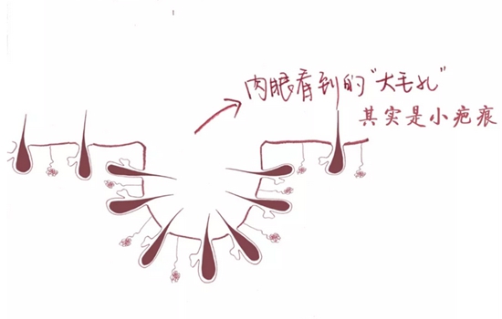 油皮毛孔大用什么水乳 油皮毛孔粗大护肤品