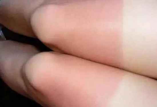 防晒与隔离哪个重要 隔离与防晒哪个好